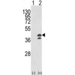 Aspartate Aminotransferase, Cytoplasmic (GOT1) Antibody