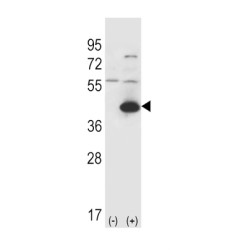 Aspartate Aminotransferase, Cytoplasmic (GOT1) Antibody