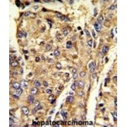 Heterogeneous Nuclear Ribonucleoprotein L (HNRPL) Antibody