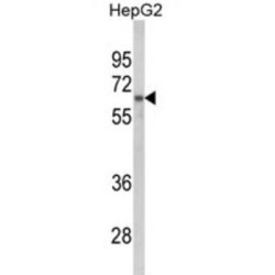 Heterogeneous Nuclear Ribonucleoprotein L (HNRPL) Antibody