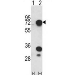 Heterogeneous Nuclear Ribonucleoprotein L (HNRPL) Antibody