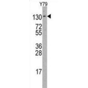 Abelson Tyrosine-Protein Kinase 2 (ABL2) Antibody