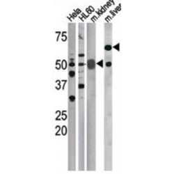 M-Phase Inducer Phosphatase 1 Phospho-Ser75 (CDC25A pS75) Antibody