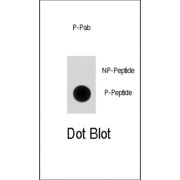 p21Cip1 (pS130) Antibody