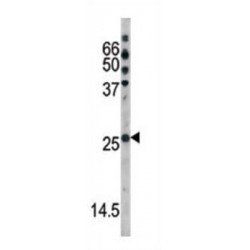 p27Kip1 (pS178) Antibody