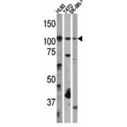 RB (pS612) Antibody
