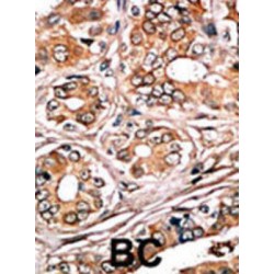 Rb (pS780) Antibody