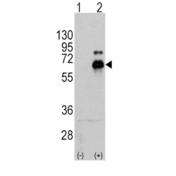 Ribosomal Protein S6 Kinase Beta-1 (S6K) Antibody