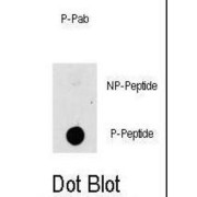 MAP3K8 (pT290) Antibody