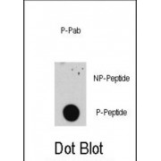 E2F1 (pS332) Antibody