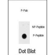 INSR (pY1185) Antibody