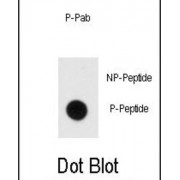 MBP (pY203) Antibody