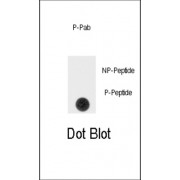 SPRY4 (pY75) Antibody