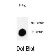 JMJD2B (pS566) Antibody