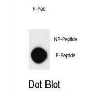 ERBB2 (pY877) Antibody