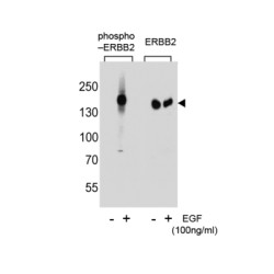 ERBB2 (pY877) Antibody