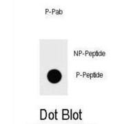 IKKB (pS672) Antibody