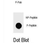 mouse KIT (pY719) Antibody