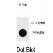 KIT (pY730) Antibody