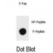 rat TSC1 (pS312) Antibody