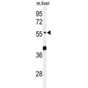 Atlastin 3 (ATL3) Antibody