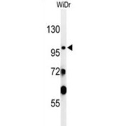 Sac Domain-Containing Inositol Phosphatase 2 (SAC2) Antibody