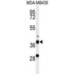 Dehydrogenase/Reductase 7 (DHRS7) Antibody