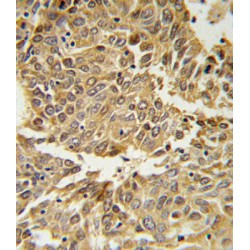 Hypoxia Inducible Factor 1 Alpha (HIF1a) Antibody