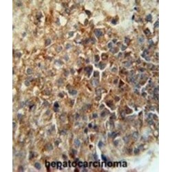 Membrane Cofactor Protein (CD46) Antibody