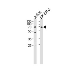 Membrane Cofactor Protein (CD46) Antibody