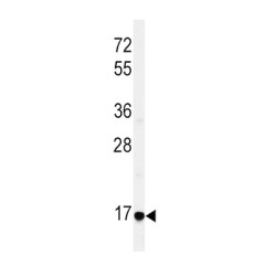 Epiregulin (EREG) Antibody