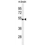 WB analysis of mouse brain tissue.