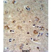 SET Domain Containing Protein 6 (SETD6) Antibody