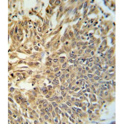 Hypoxia Inducible Factor 1 Alpha (HIF1a) Antibody