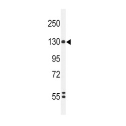 Hypoxia Inducible Factor 1 Alpha (HIF1a) Antibody