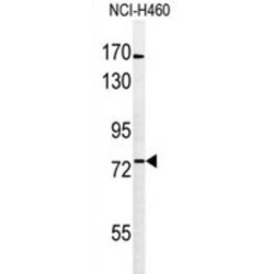 Bardet-Biedl Syndrome 10 Protein (BBS10) Antibody