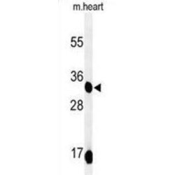 Coenzyme Q9 (COQ9) Antibody