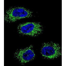 Heat Shock Protein 90 kDa Beta 1 (HSP90B1) Antibody