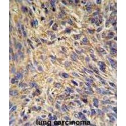 Heat Shock Protein 90 kDa Beta 1 (HSP90B1) Antibody