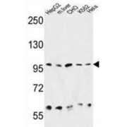 WB analysis of (1) HepG2 cell line lysate, (2) Mouse Liver tissue lysate, (3) CHO cell line lysate, (4) K562 cell line lysate, and (5) HeLa cell line lysate.