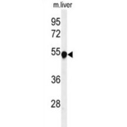 Phenylalanine Hydroxylase (PAH) Antibody