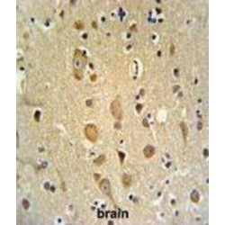 Centromere Protein S (APITD1) Antibody