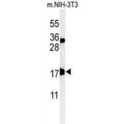 Centromere Protein S (APITD1) Antibody