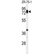 Hyaluronan Synthase 1 (HAS1) Antibody