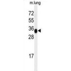 Microfibrillar Associated Protein 4 (MFAP4) Antibody