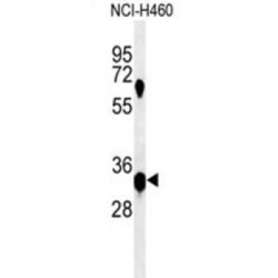 BTB/POZ Domain-Containing Protein KCTD1 (KCTD1) Antibody