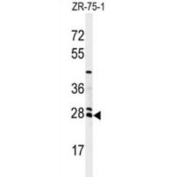 N-Acetyltransferase 8 (NAT8) Antibody