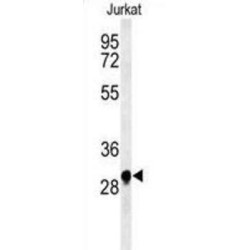 Ankyrin Repeat Domain-Containing Protein 49 (ANR49) Antibody