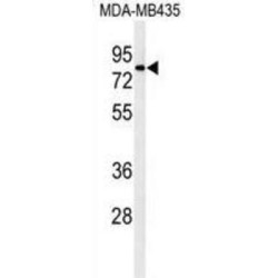 Acid Trehalase-Like Protein 1 (ATHL1) Antibody