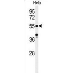 POTE Ankyrin Domain Family Member H (POTEH) Antibody